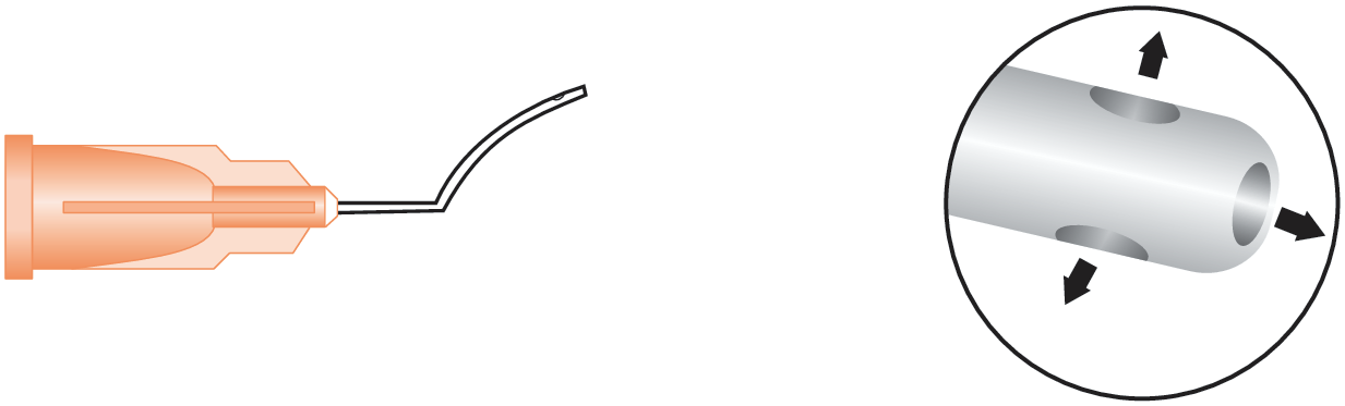 Lasik Irrigating Cannula (Rubenstein)